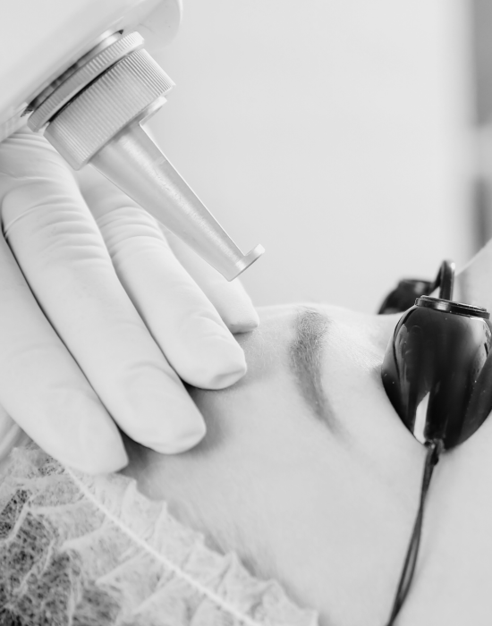 Black and white photo of a woman getting a laser treatment.